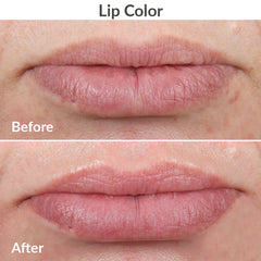 PMD Kiss Lip Plumping System - Blush